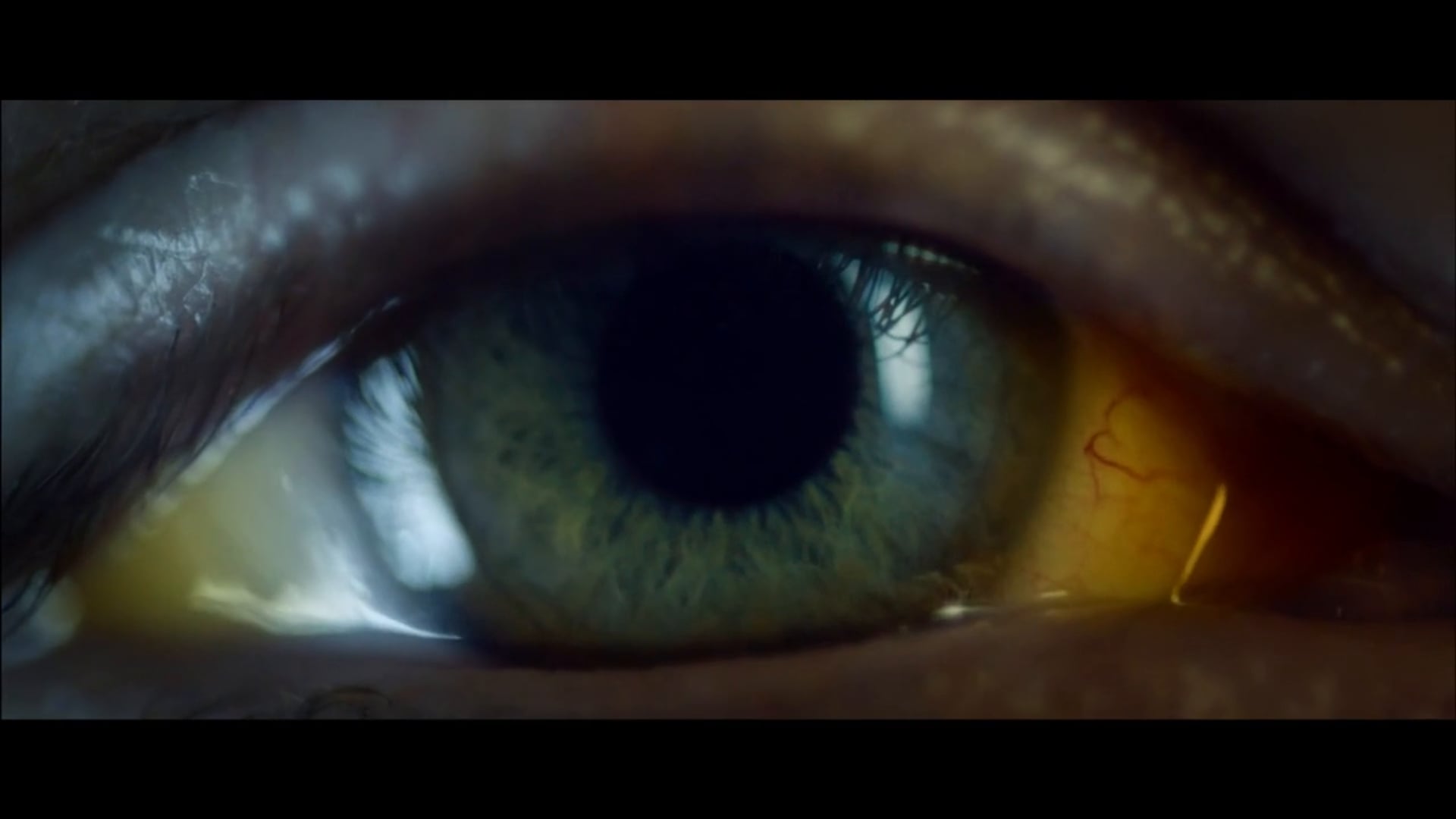 Nocebo trailer